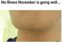 Movemberin eteneminen