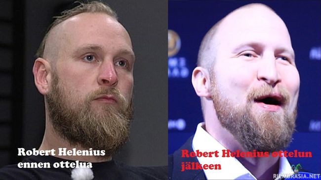 Robert Helenius - Ennen ja jälkeen ottelun
